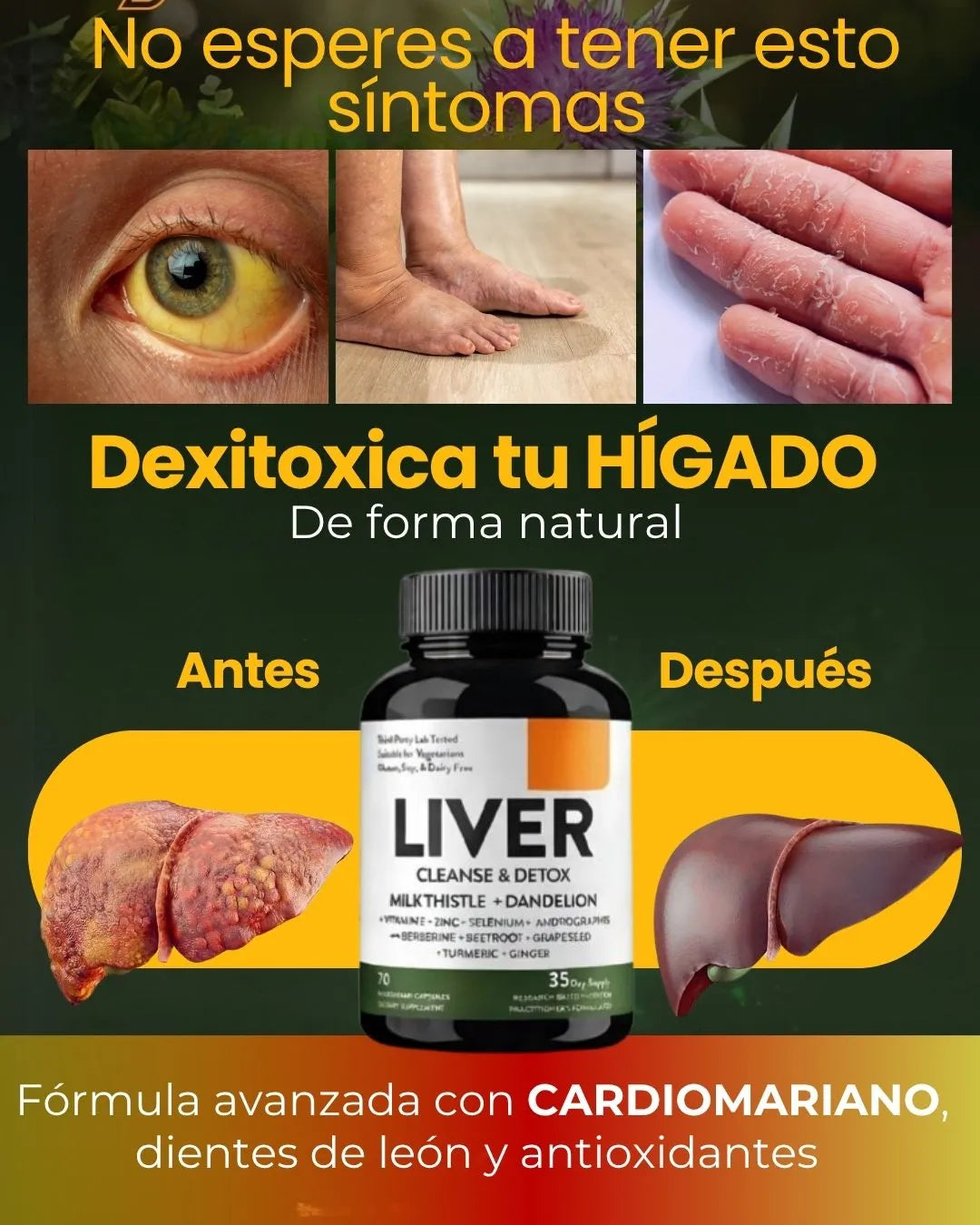 LIVER DETOX - DESINTOXICACIÓN DEL HÍGADO