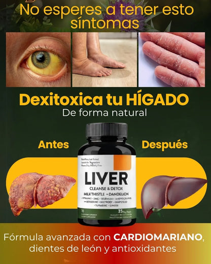 LIVER DETOX - DESINTOXICACIÓN DEL HÍGADO